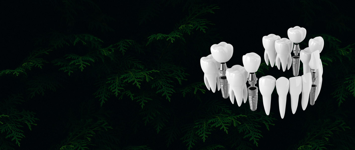 Zahnimplantat Vollnarkose Türkei Preis: Ihr Weg zu einem neuen Lächeln in Istanbul